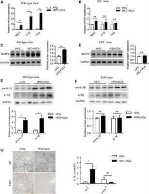 Obeticholic Acid Induces Hepatoxicity Via FXR in the NAFLD Mice